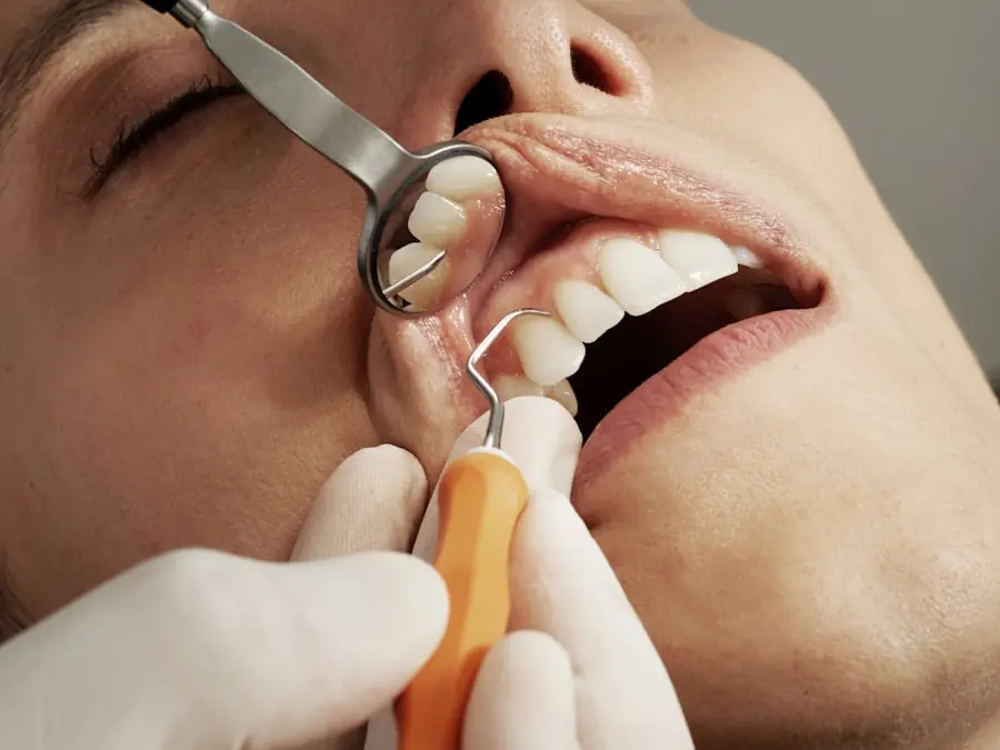 Patient showing off a bright smile makeover